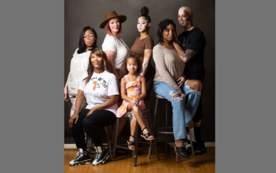 Unique photoshoot celebrates people with vitiligo