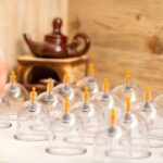 Healing benefits of Sacred Cupping: Insights from a certified Hijama practitioner