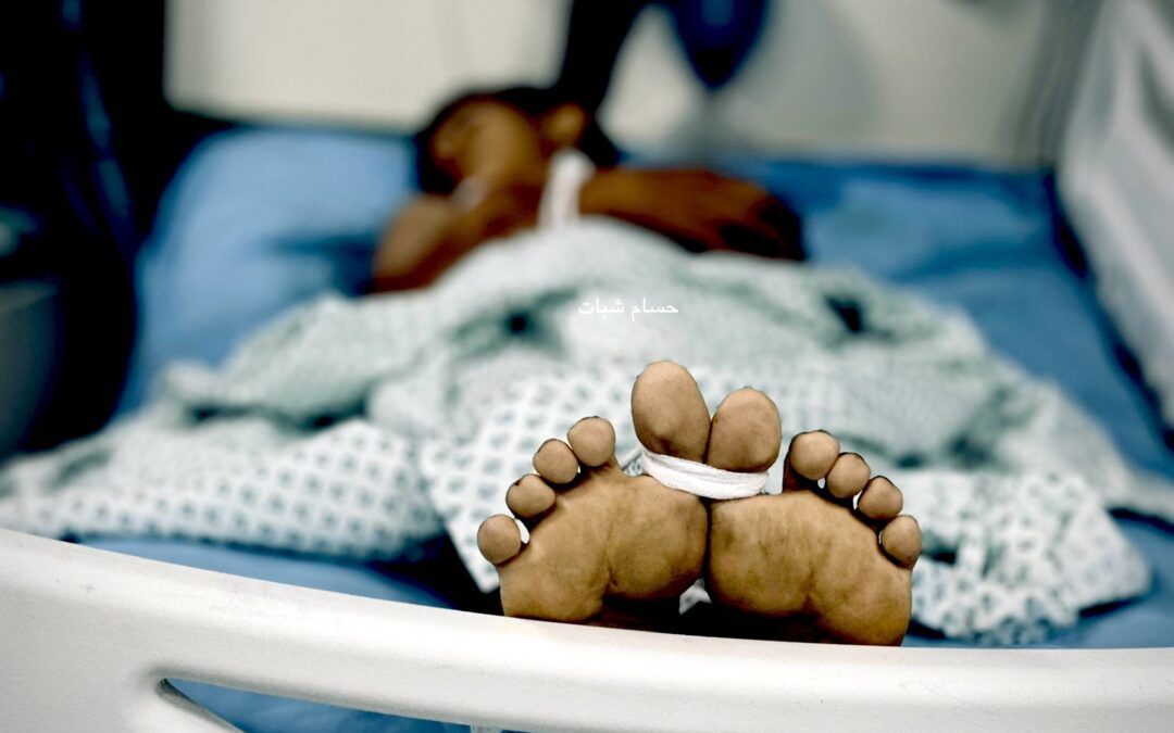 Caitlin Johnstone: Mainstream Voices Sudden Pivot on Gaza